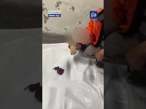 ما تبقى من جسد صغير من عائلة الطباطيبي في مدينة غزة