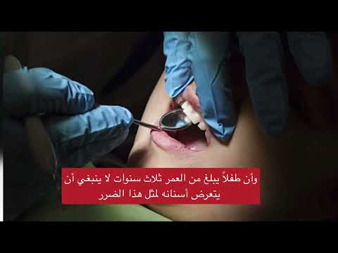 محاكمة أبوين بسبب إهمال رعاية أسنان أطفالهم